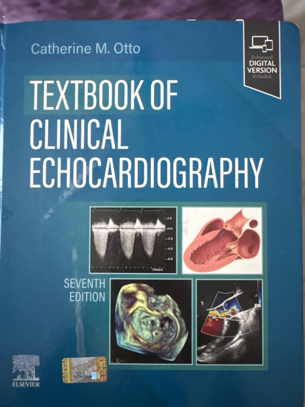 Textbook of clinical echocardiography